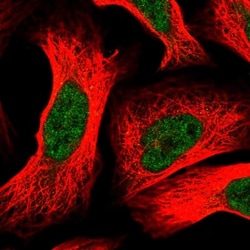 DDB1 Antibody, Novus Biologicals:Antikroppar:Primära antikroppar